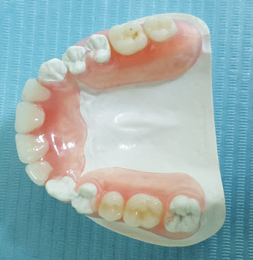 Flexible Denture