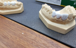 Porcelain Bonded Porcelain Bonded Hayes