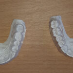 Essix Retainers