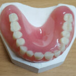 Acrylic Partial Dentures