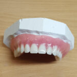 Acrylic Partial Dentures