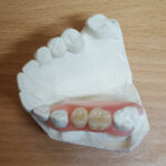 Flexi Denture and ComFlexin Dentures