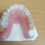 Acrylic Partial Dentures