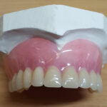 Acrylic Partial Dentures