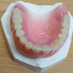 Acrylic Partial Dentures