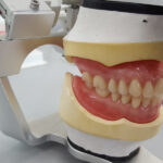 Acrylic Partial Dentures