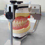 Acrylic Partial Dentures