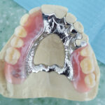Flexi Denture and ComFlexin Dentures